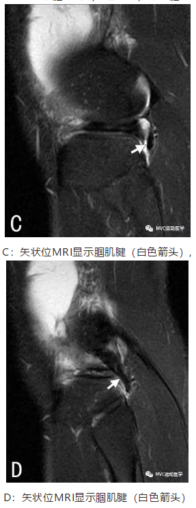 微信截图_20181018112657.png