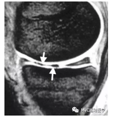 微信截图_20181018112823.png