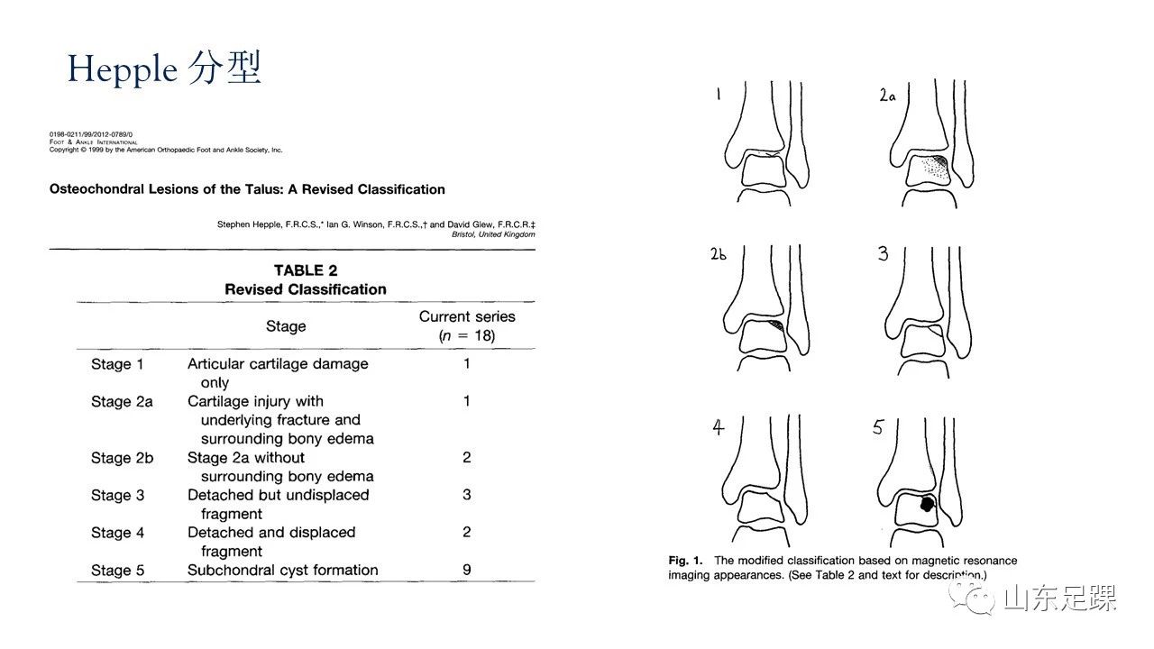 一篇掌握：OLT治疗中内踝截骨的方式