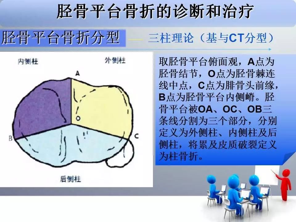 一篇掌握：胫骨平台骨折的诊断与治疗技巧