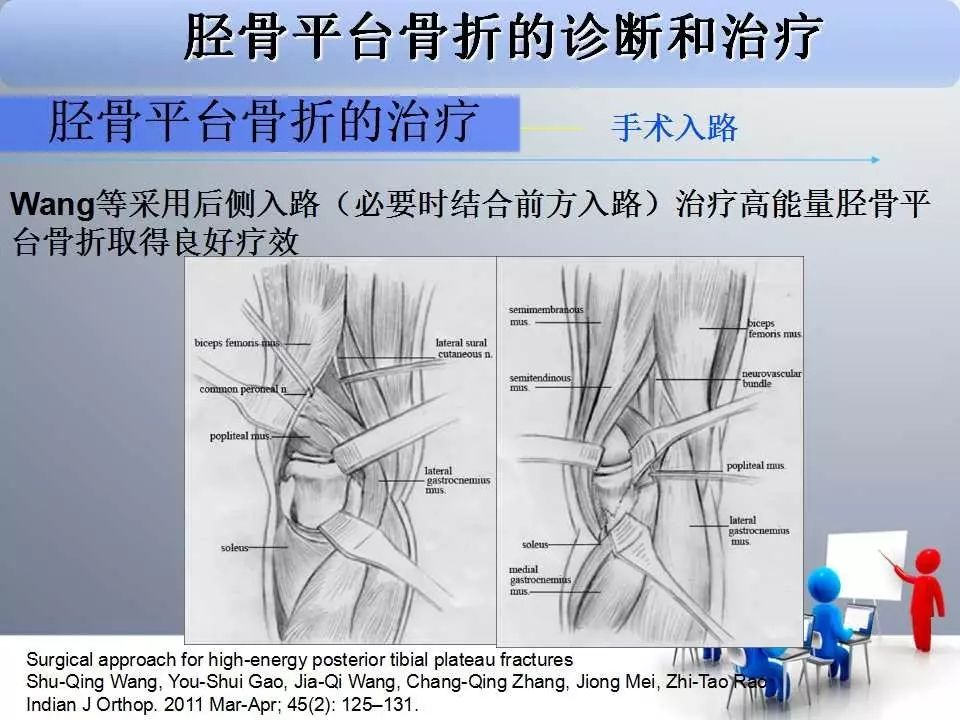 一篇掌握：胫骨平台骨折的诊断与治疗技巧