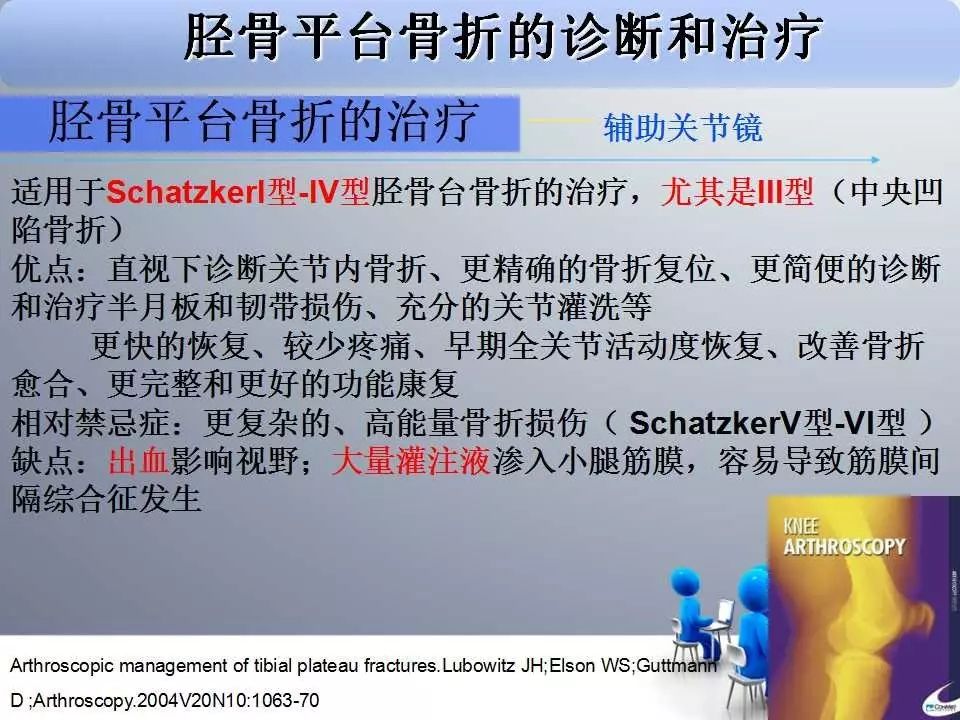 一篇掌握：胫骨平台骨折的诊断与治疗技巧