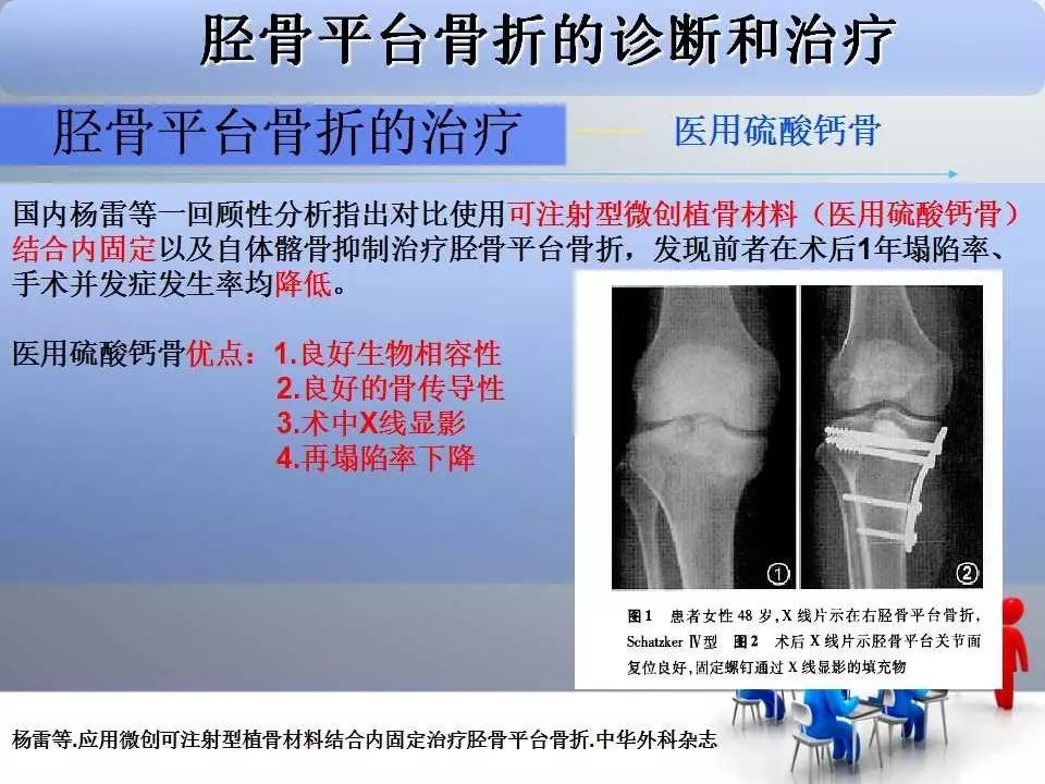 一篇掌握：胫骨平台骨折的诊断与治疗技巧