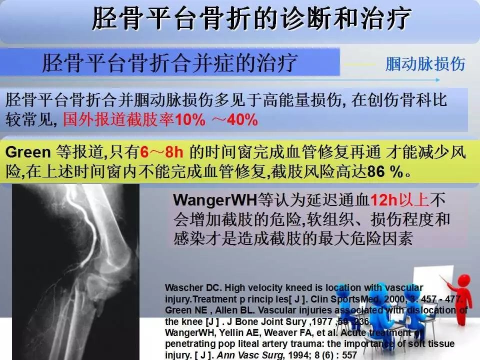 一篇掌握：胫骨平台骨折的诊断与治疗技巧