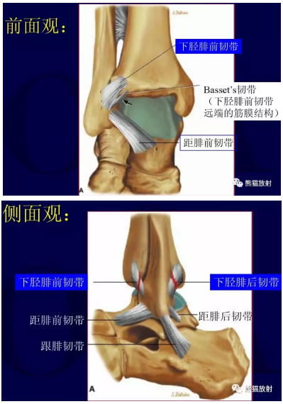 一篇掌握：踝关节的韧带解剖及损伤表现