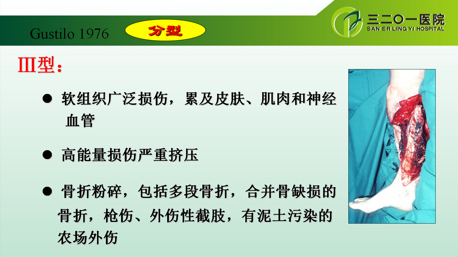 一篇课件详解：开放性骨折的分类及治疗策略！