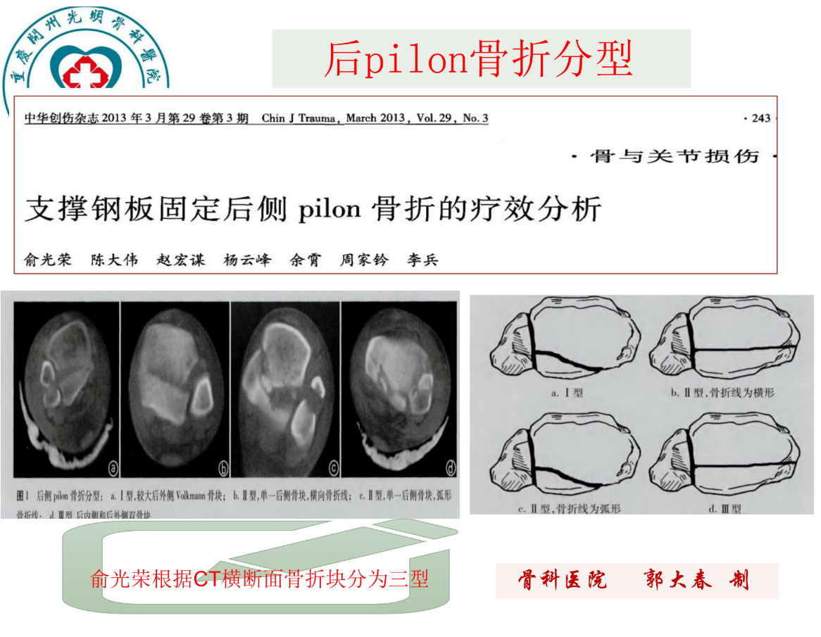 关于后pilon骨折的治疗策略，看这篇就够了！