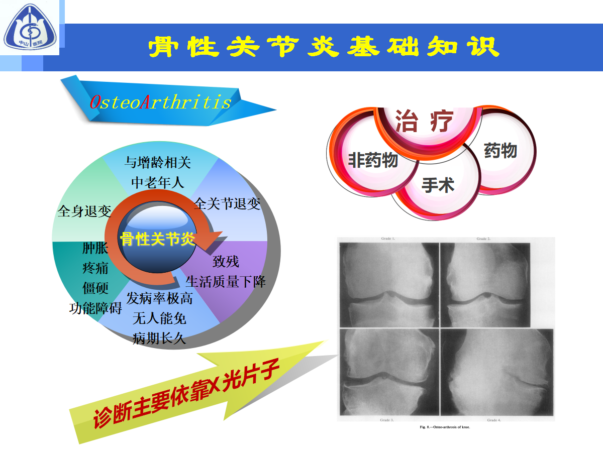 骨性关节炎的手术治疗策略，都在这篇课件里！