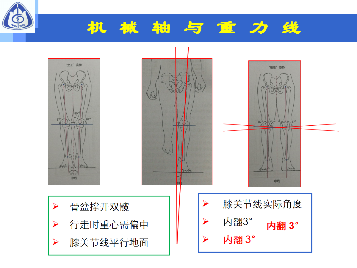 骨性关节炎的手术治疗策略，都在这篇课件里！