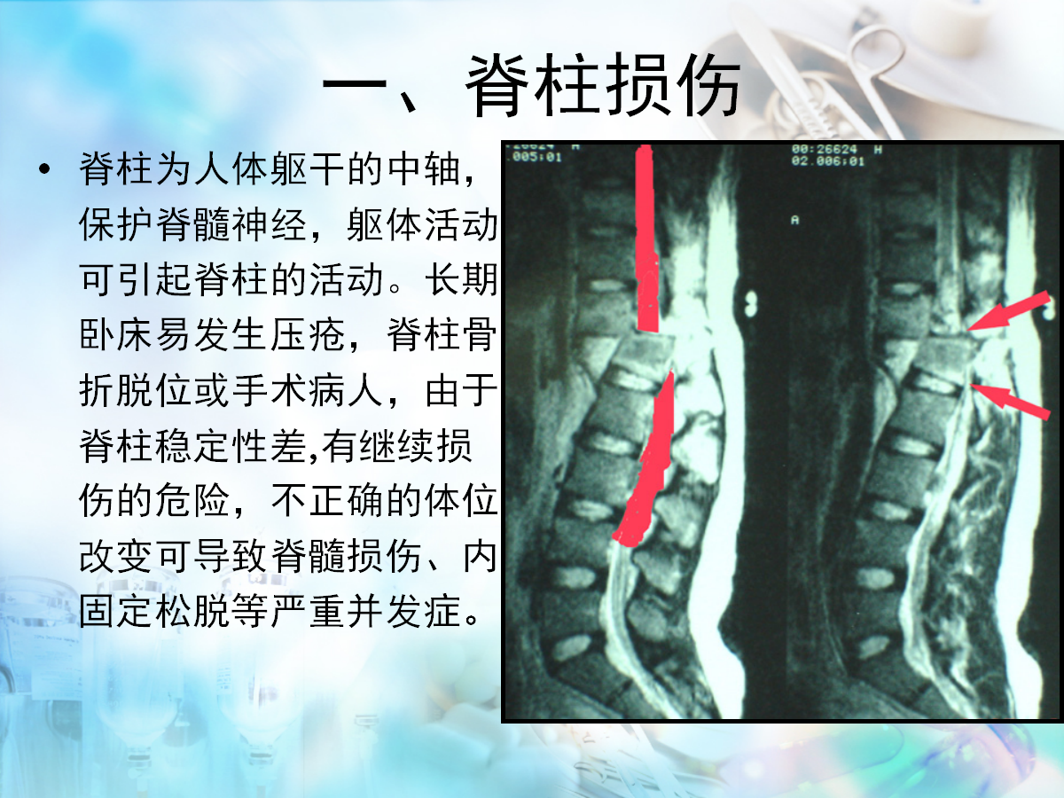 骨科病人护理翻身技巧，看完记得收藏！