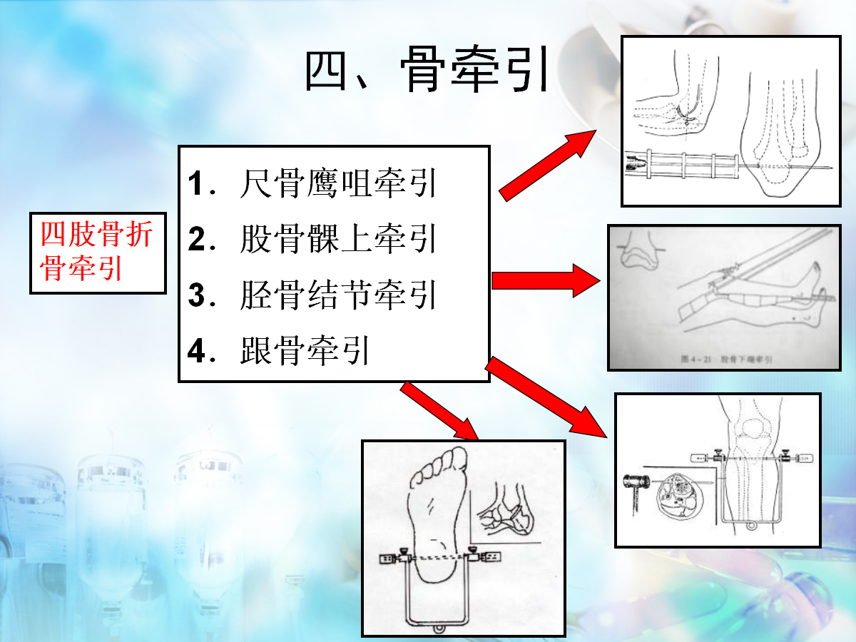 骨科病人护理翻身技巧，看完记得收藏！