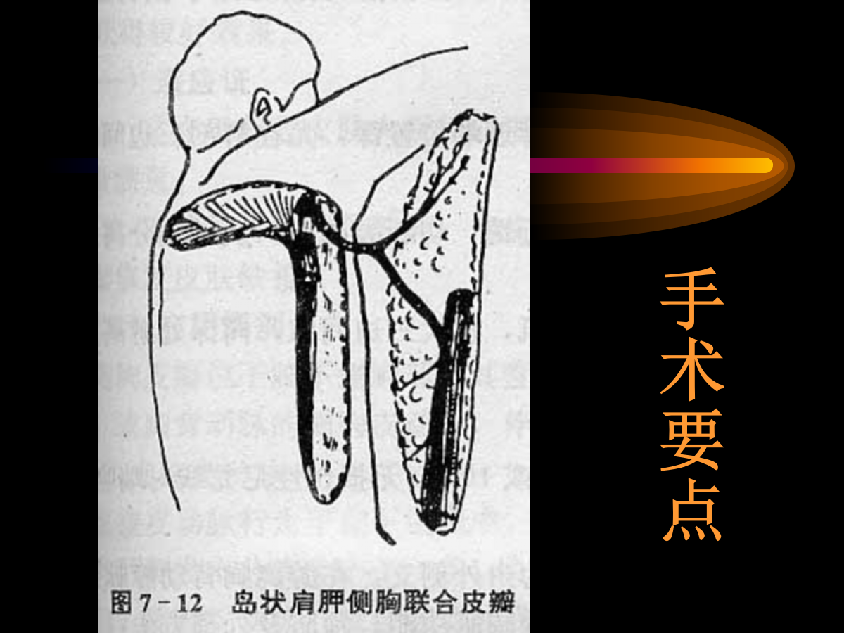 系统详解：骨科常用游离肌皮瓣及皮瓣！