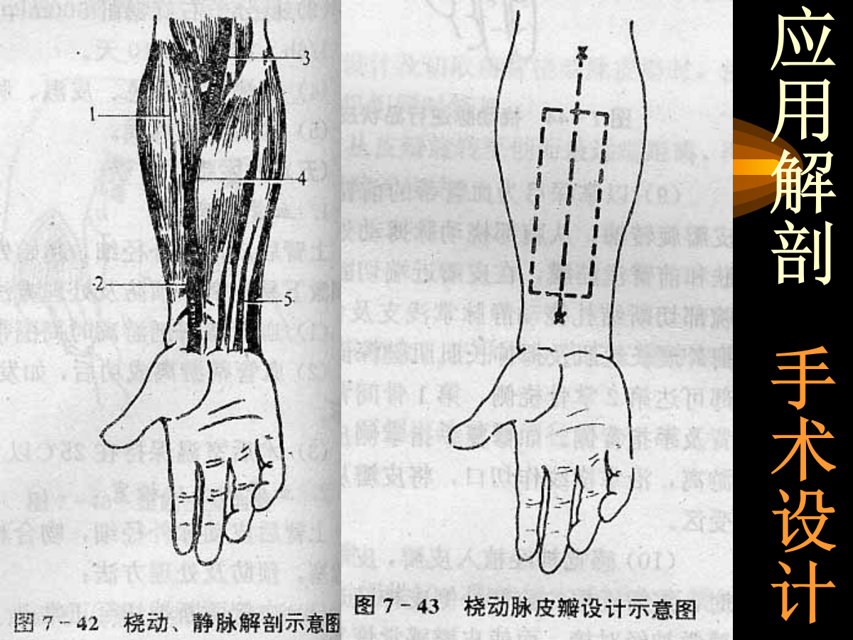 系统详解：骨科常用游离肌皮瓣及皮瓣！