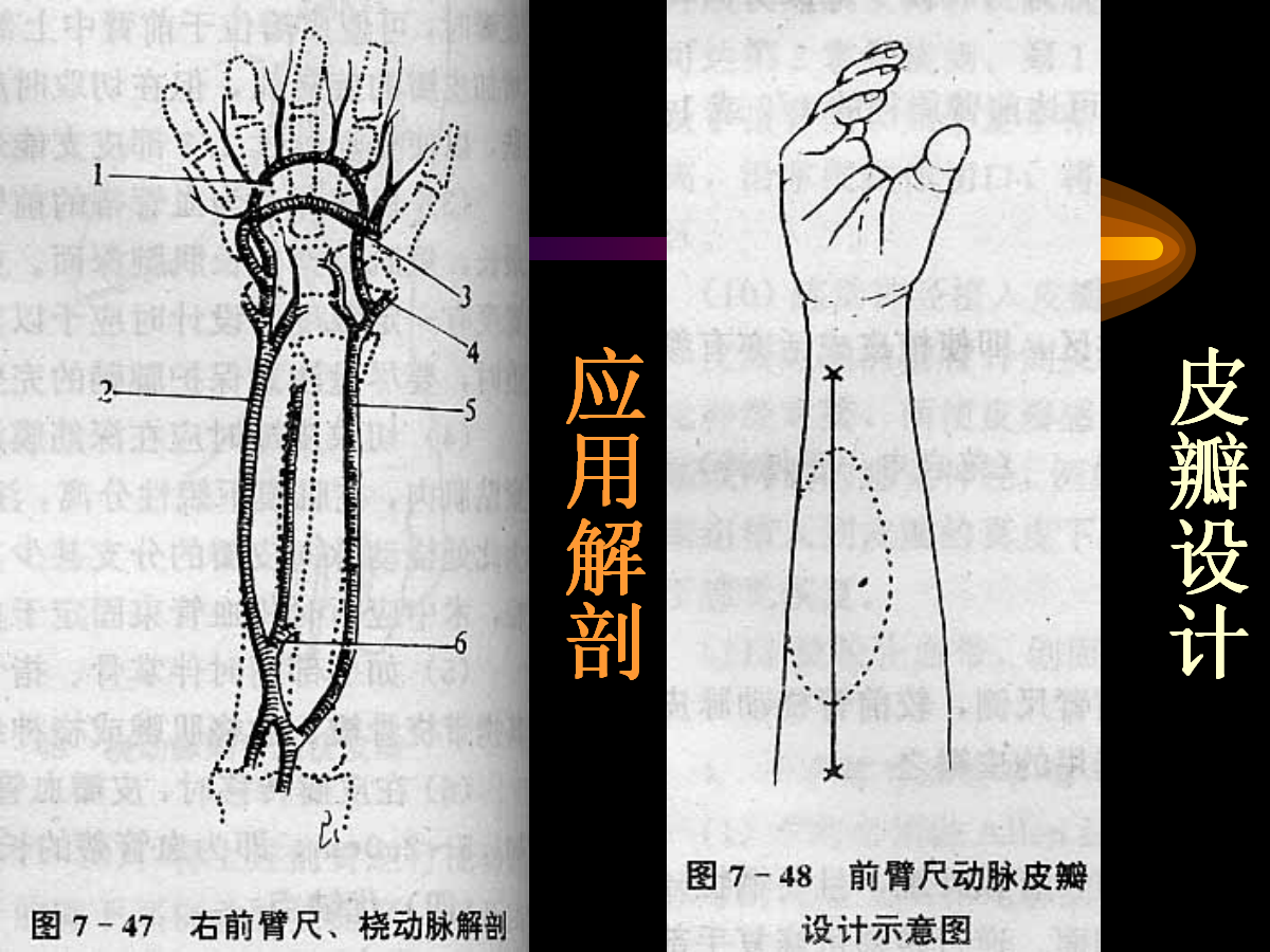 系统详解：骨科常用游离肌皮瓣及皮瓣！