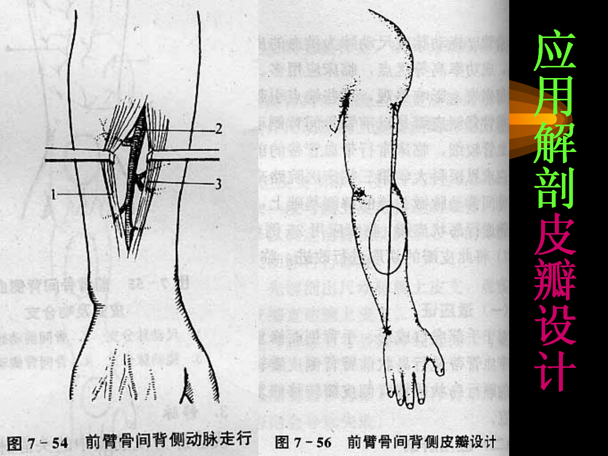 系统详解：骨科常用游离肌皮瓣及皮瓣！