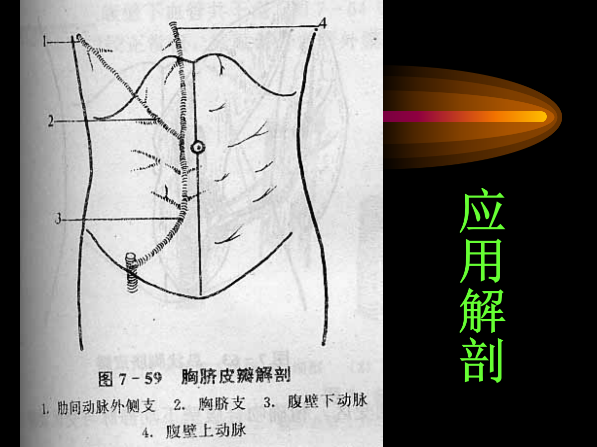 系统详解：骨科常用游离肌皮瓣及皮瓣！