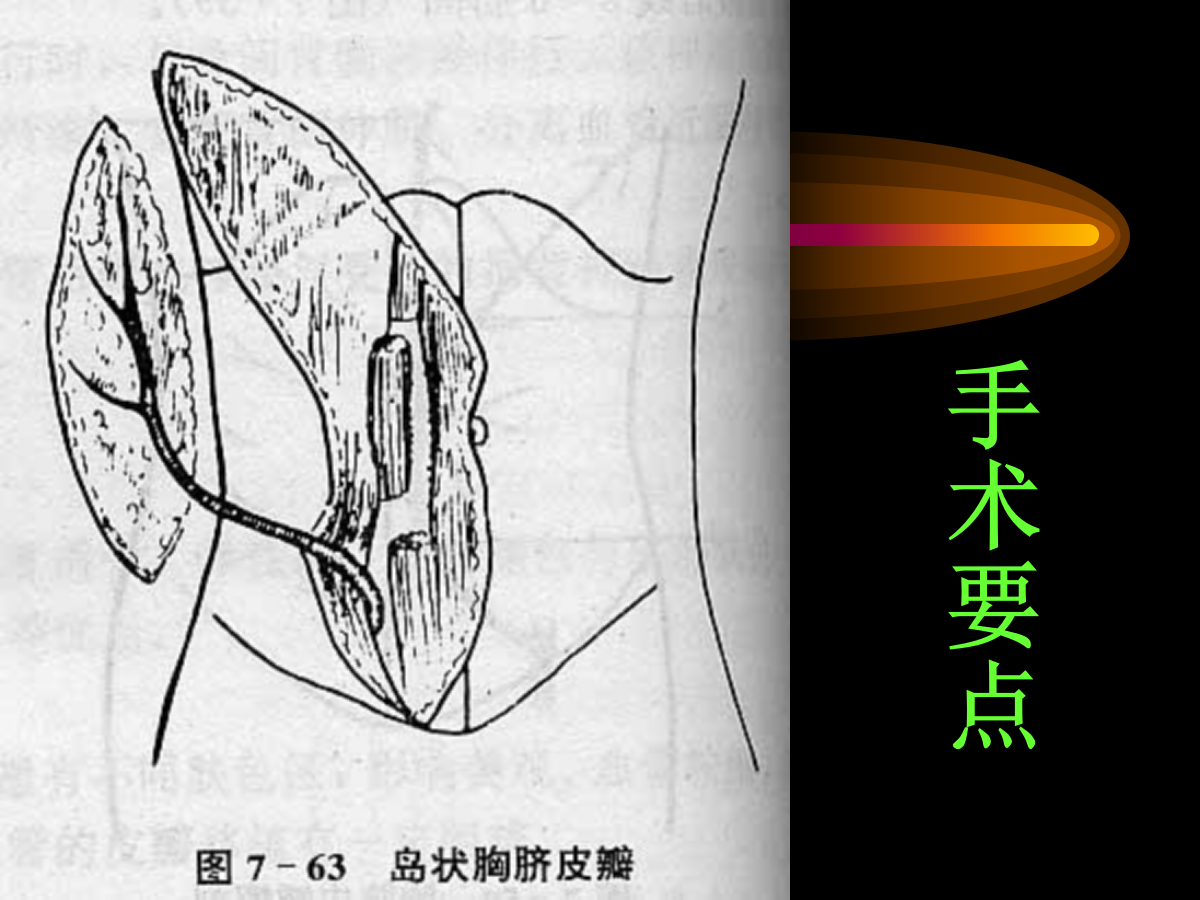 系统详解：骨科常用游离肌皮瓣及皮瓣！