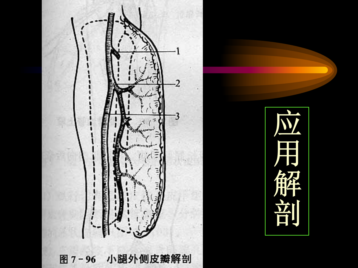 系统详解：骨科常用游离肌皮瓣及皮瓣！