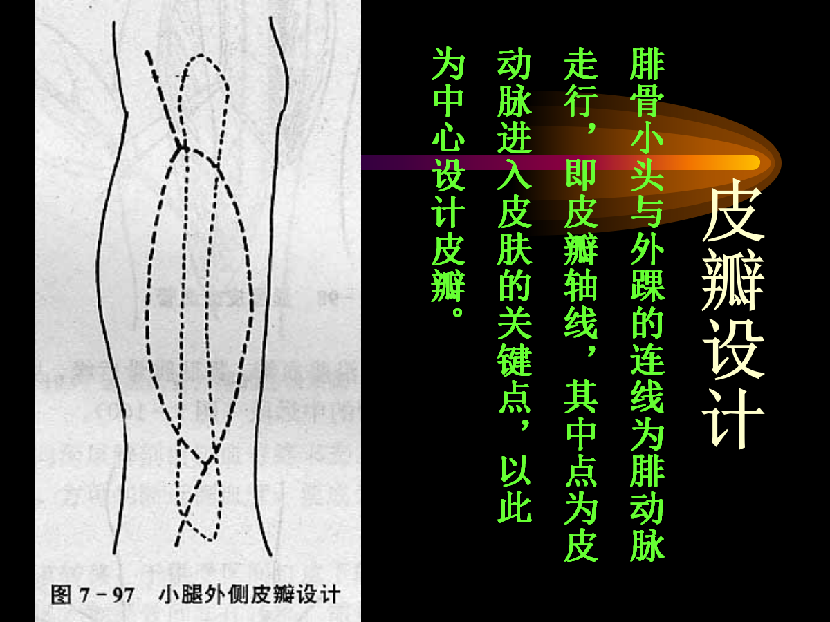 系统详解：骨科常用游离肌皮瓣及皮瓣！