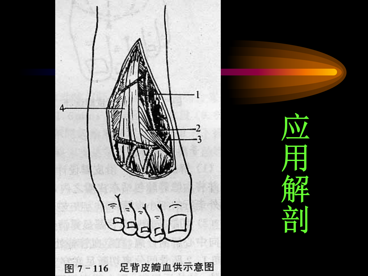 系统详解：骨科常用游离肌皮瓣及皮瓣！