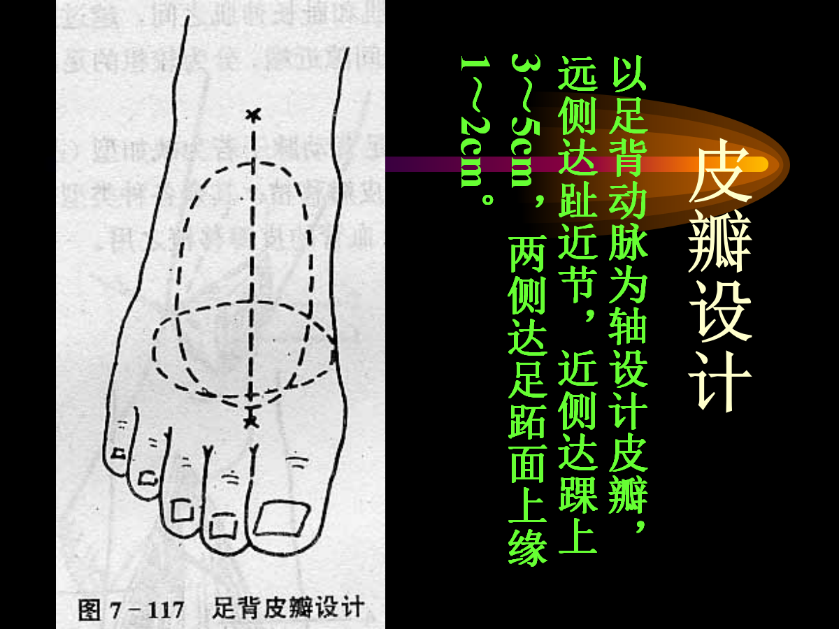 系统详解：骨科常用游离肌皮瓣及皮瓣！