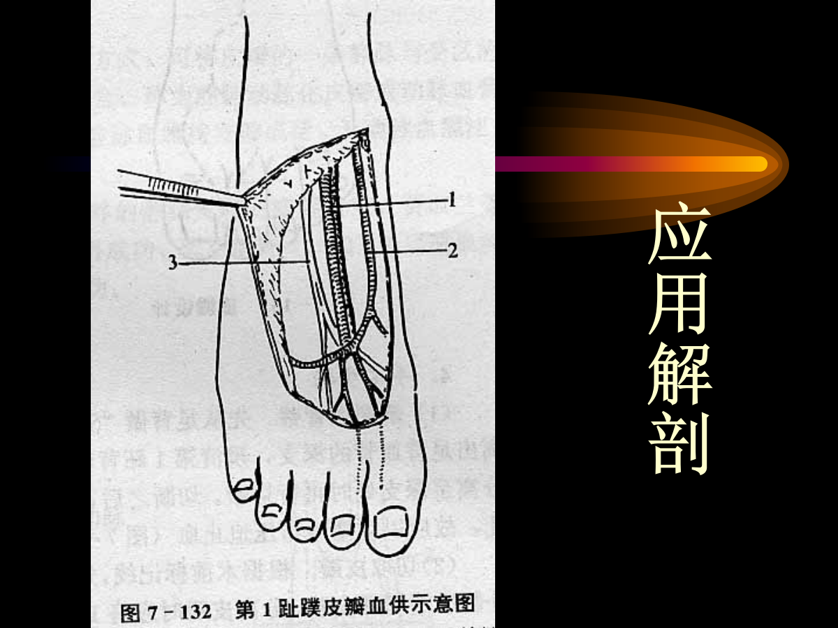 系统详解：骨科常用游离肌皮瓣及皮瓣！