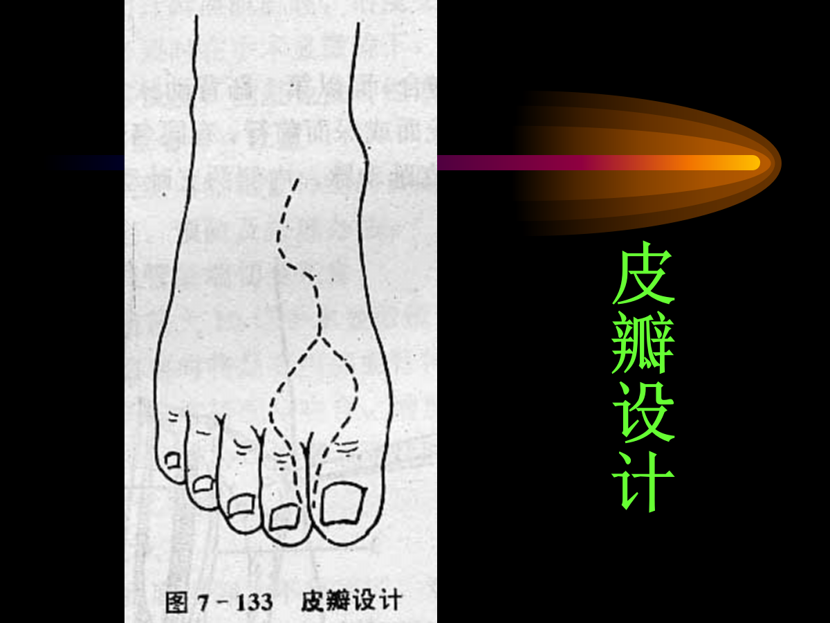 系统详解：骨科常用游离肌皮瓣及皮瓣！