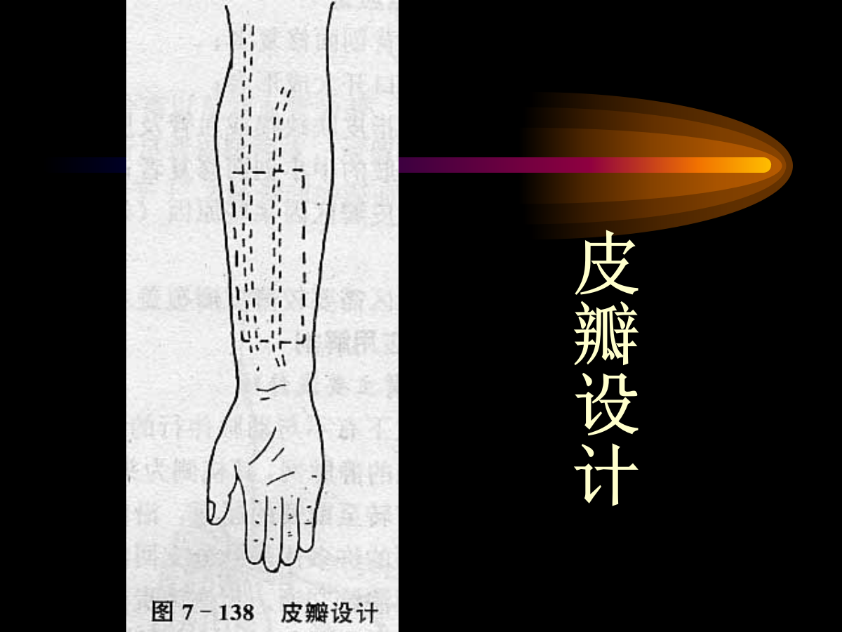 系统详解：骨科常用游离肌皮瓣及皮瓣！