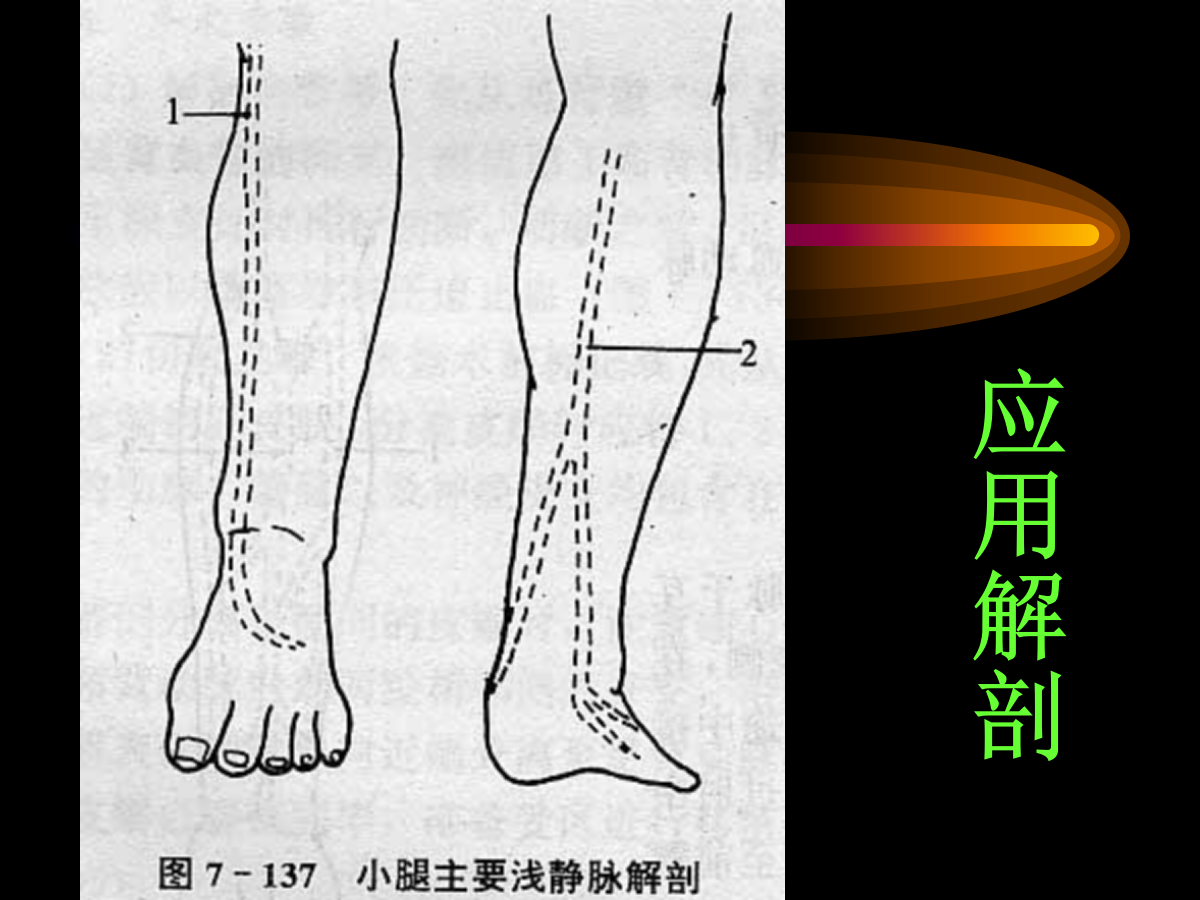 系统详解：骨科常用游离肌皮瓣及皮瓣！