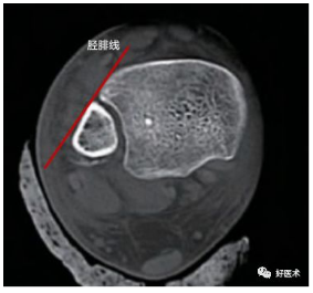 微信截图_20181220105538.png