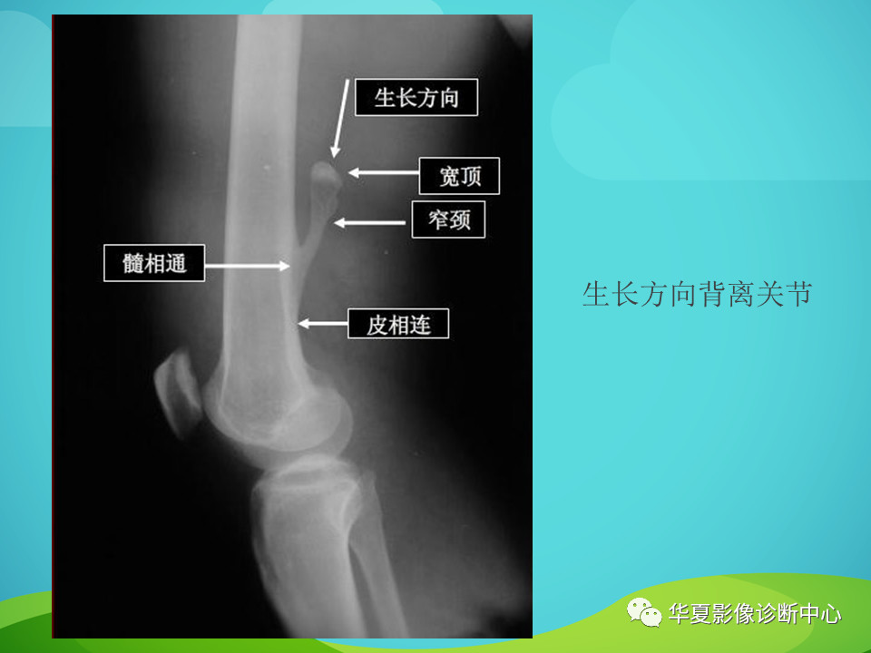 骨关节正常变异汇总，值得收藏！