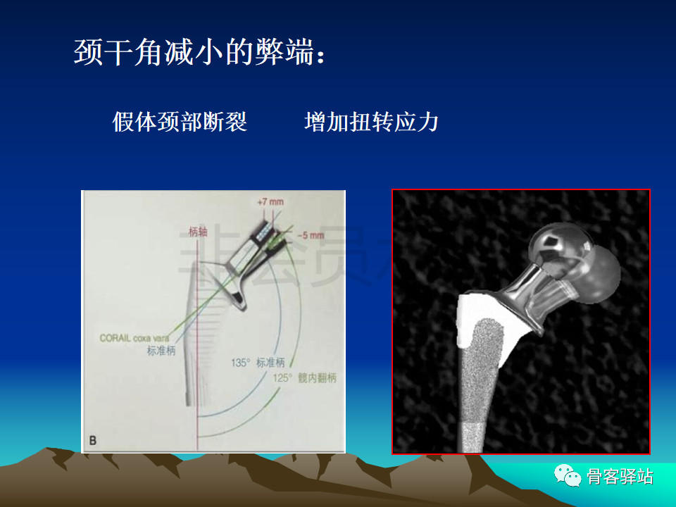 髋臼旋转中心图片