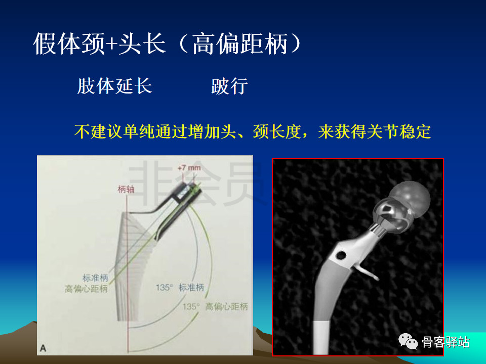 人工髋关节翻修髋臼侧重建旋转中心难点解析