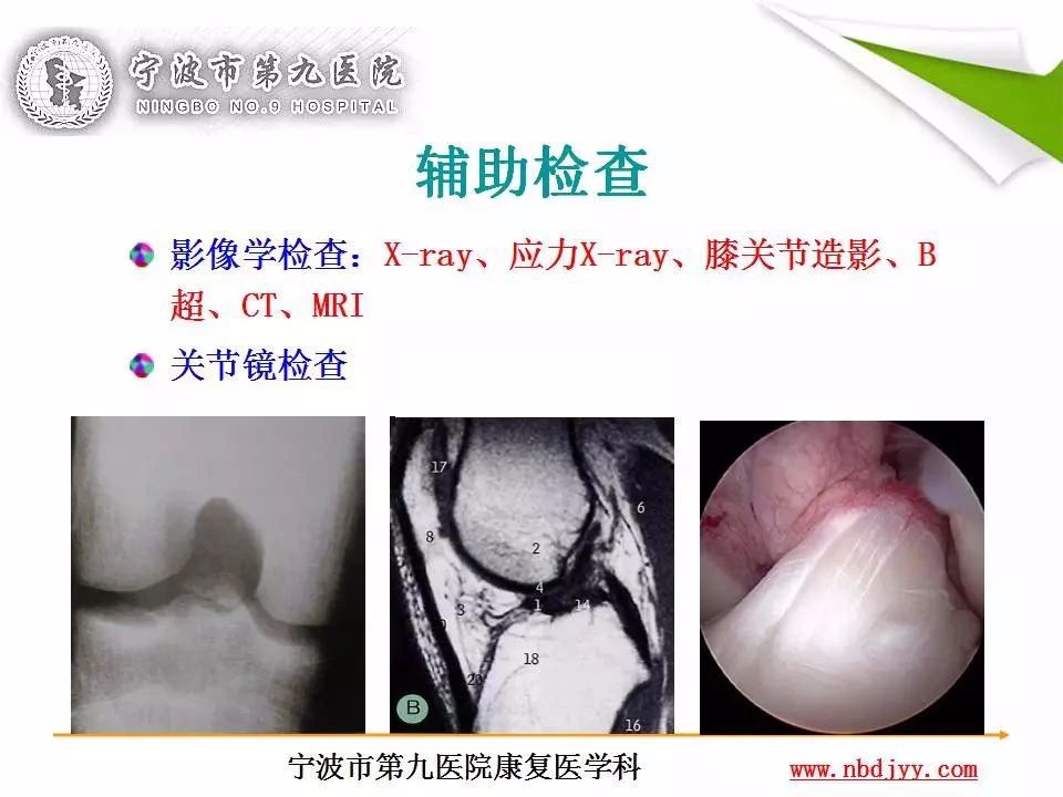 一篇掌握：前交叉韧带重建及术后康复