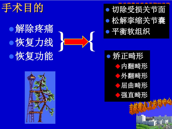 膝关节置换截骨平面的选择，看这篇！