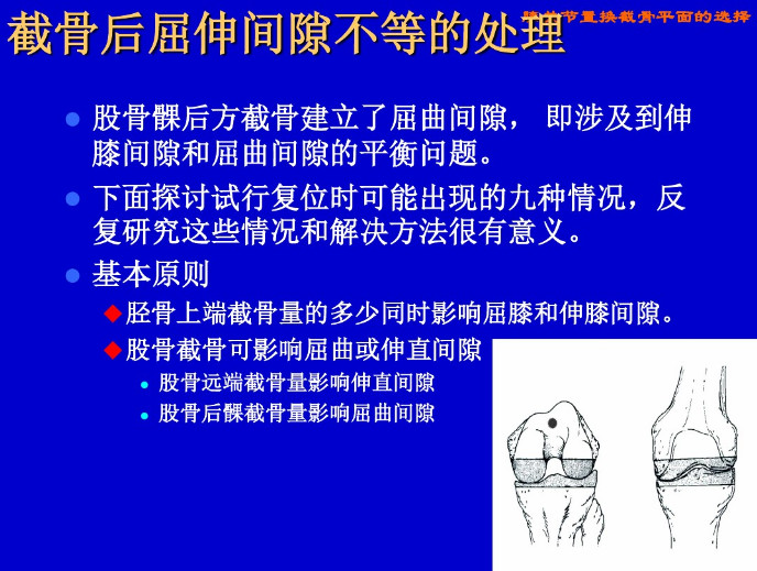 膝关节置换截骨平面的选择，看这篇！