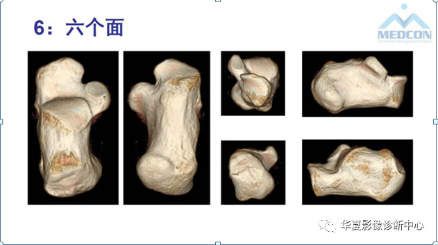 跟骨病变都在这里，赶快收藏吧！