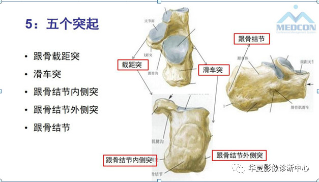 跟骨病变都在这里，赶快收藏吧！