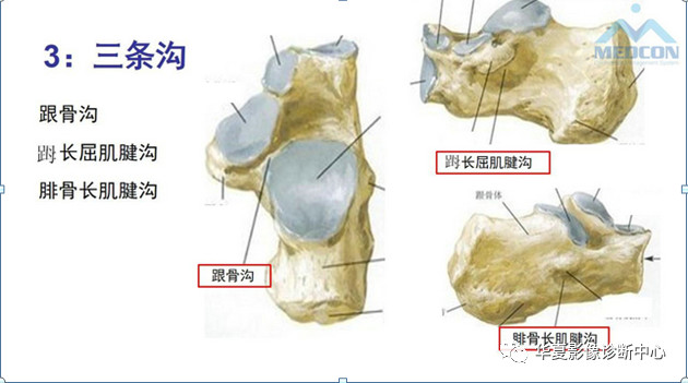 跟骨病变都在这里，赶快收藏吧！