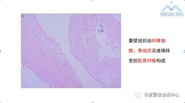 跟骨病变都在这里，赶快收藏吧！