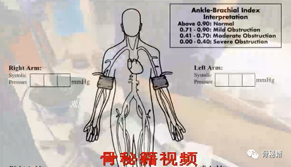 【美国急诊骨科】膝关节脱位复位实录