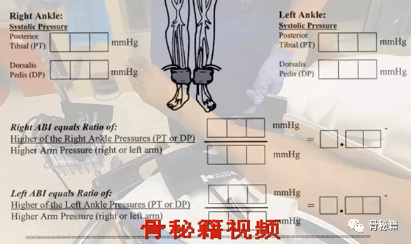 【美国急诊骨科】膝关节脱位复位实录