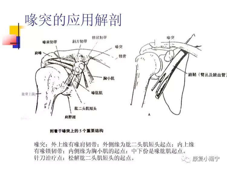 专业！Maitland手法治疗肩周炎，详细图文