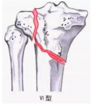 微信截图_20190226102105.png