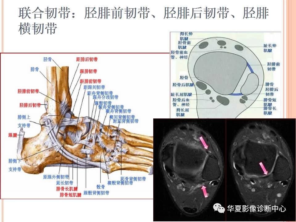 一文详解：踝关节MRI解剖及常见损伤类型