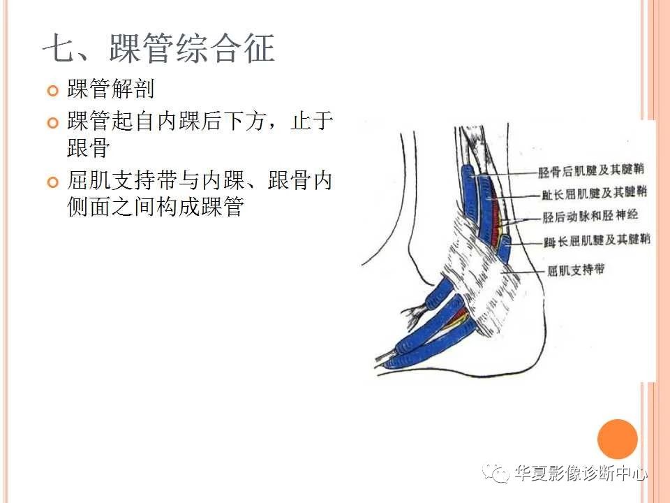 一文详解：踝关节MRI解剖及常见损伤类型