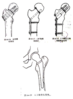 微信截图_20190319101320.png