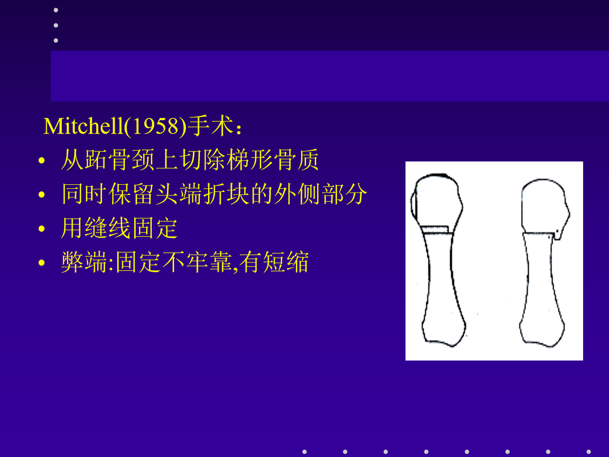 拇外翻的分型及治疗策略，一文搞定！