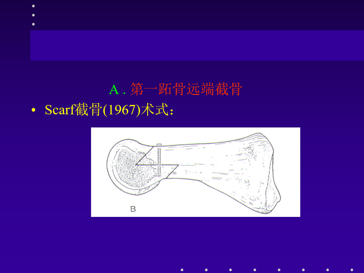 拇外翻的分型及治疗策略，一文搞定！