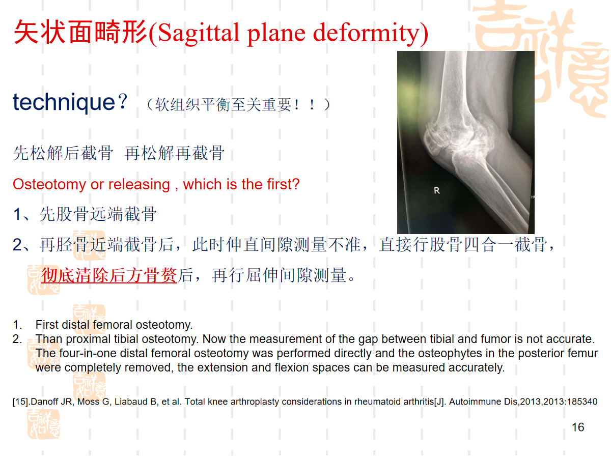 复杂初次全膝关节置换，遇到了该怎么办？